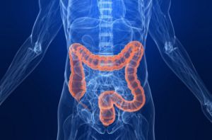 colorectal-cancer